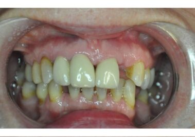 need for dental treatment