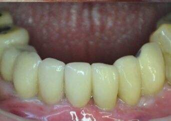 results of comprehensive dental treatment