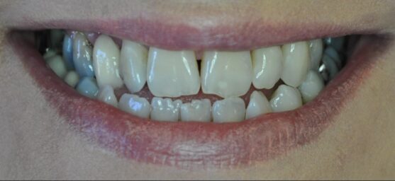 complex dental treatment