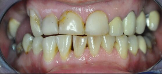 comprehensive dental treatment reading
